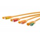 Foley Catheter 2 Way Balloon Size